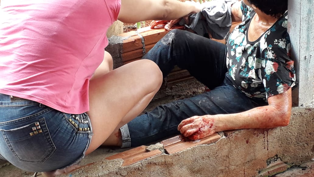Imagem referente a Duas mulheres são esfaqueadas no Bairro Santa Cruz