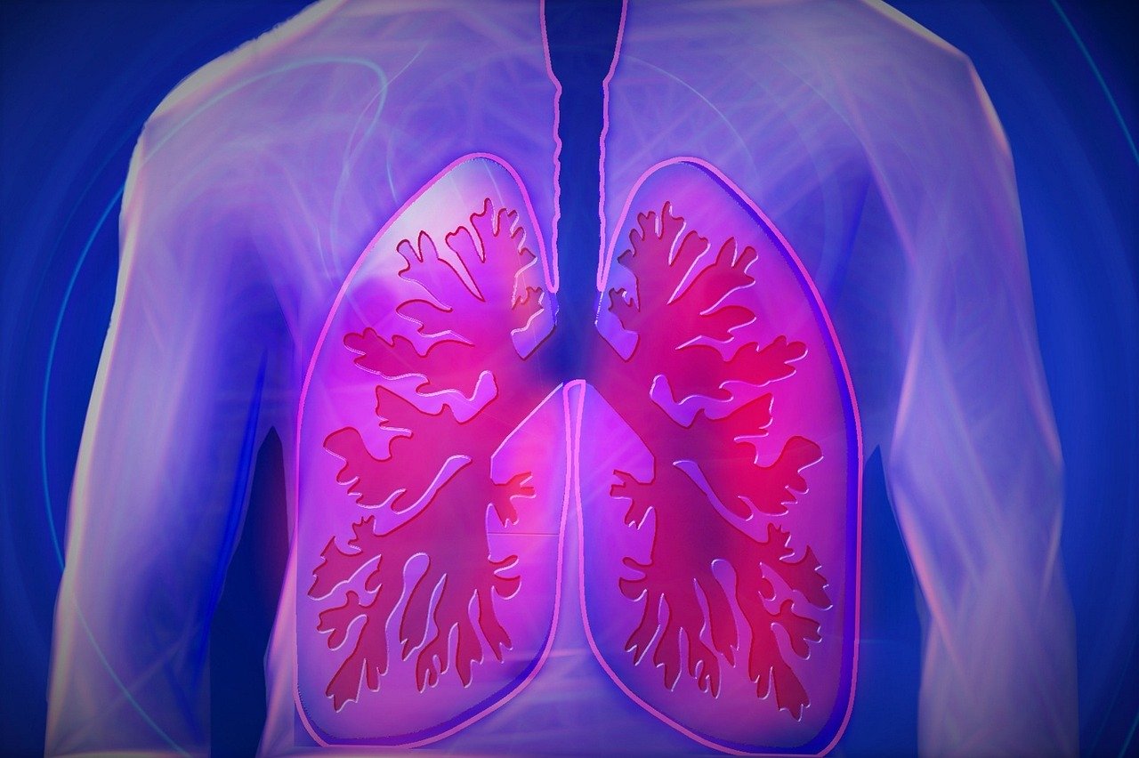 Imagem referente a Câncer de pulmão costuma ser ‘bastante agressivo’, diz especialista