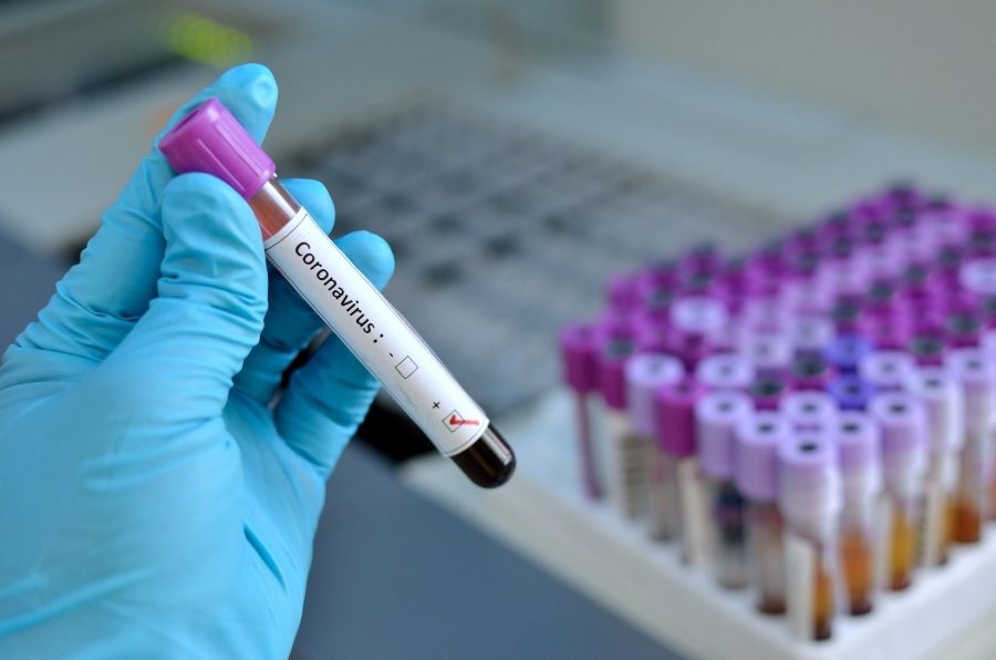 Testagem Epicovid-19 encerra segunda fase em Cascavel; foram 250 pessoas testadas e nenhum caso positivo
