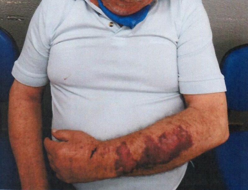 Imagem referente a Seis envolvidos em roubo onde idoso foi agredido são condenados e penas somam 78 anos de prisão