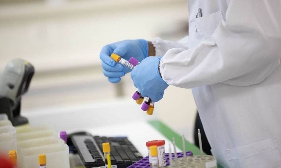 Teste que reduz custo para detectar anticorpos da covid-19 é desenvolvido pela USP