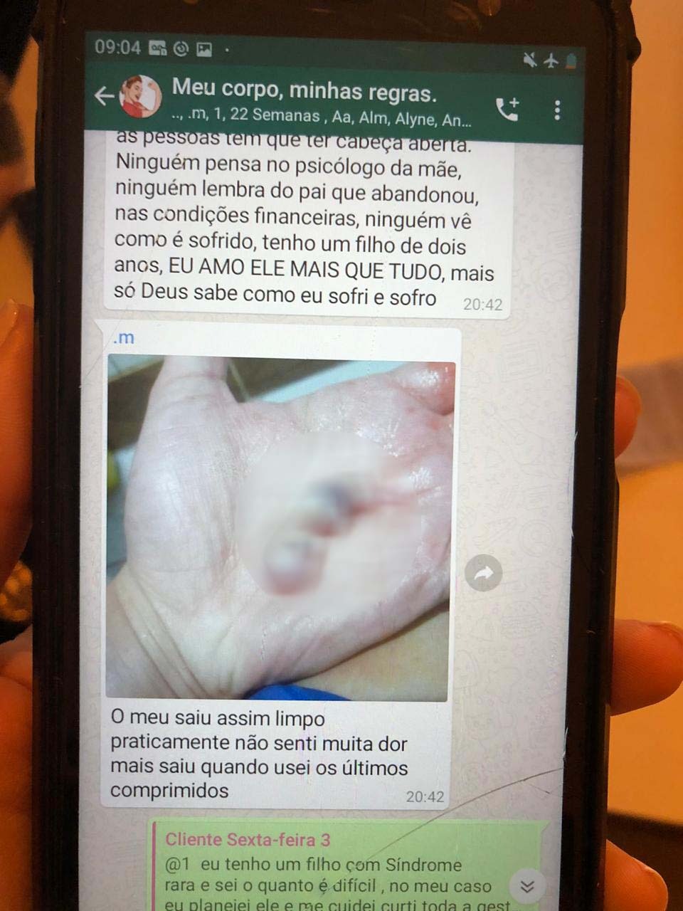 Imagem referente a Supostos clientes mandavam fotos de fetos abortados em grupo do whatsapp