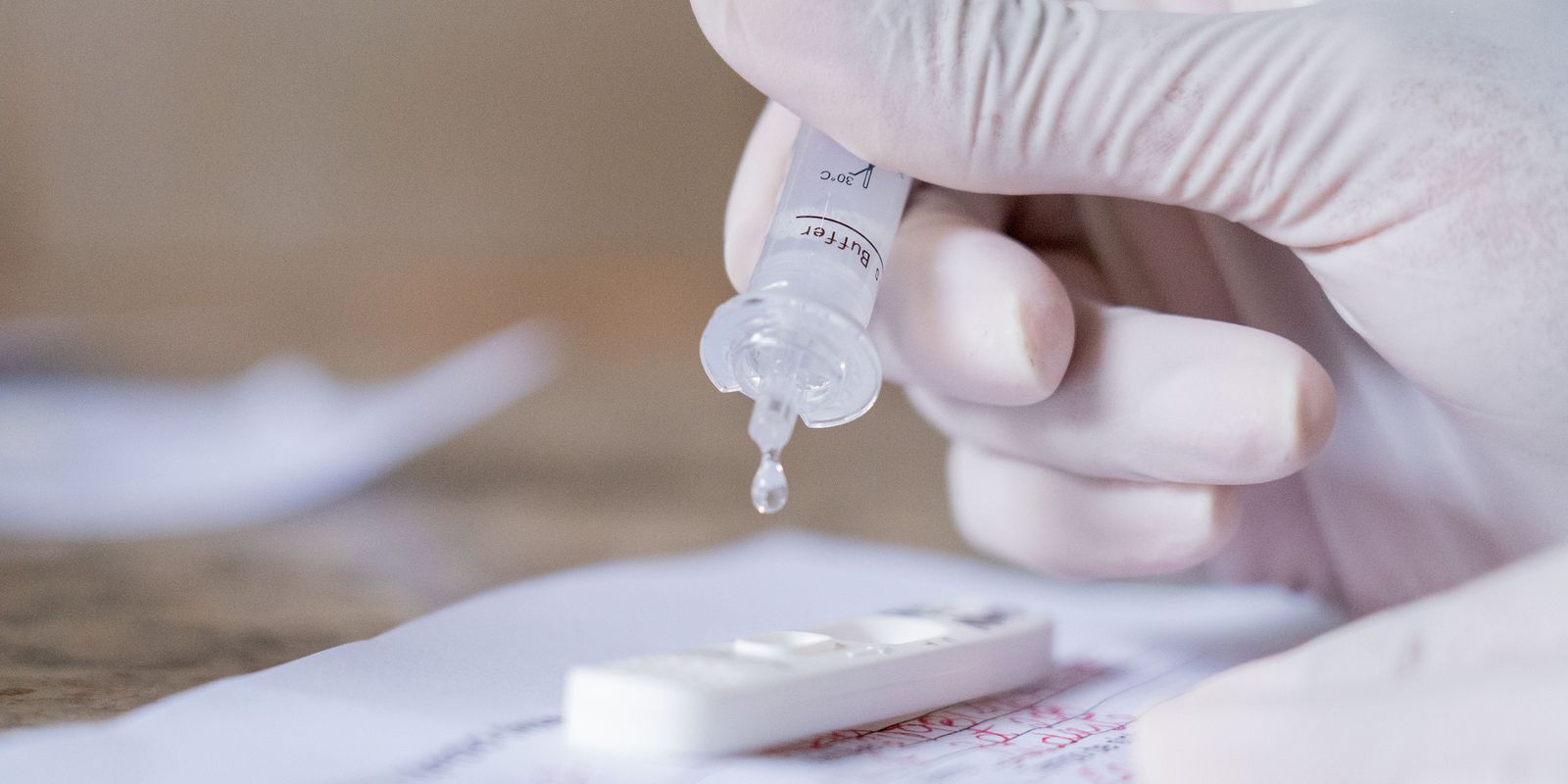Imagem referente a Prefeitura adquire testes rápidos para constatação de maconha, cocaína e outras drogas na urina