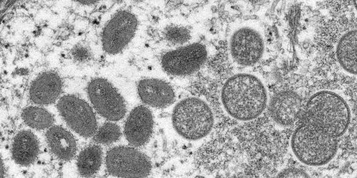 Sala de situação vai monitorar varíola dos macacos no país