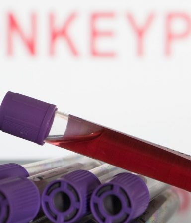 Cascavel confirma primeiro caso de Monkeypox - Varíola dos Macacos