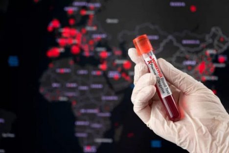 Anvisa aprova o registro do 1º teste para diagnóstico da varíola dos macacos