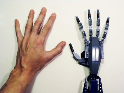 Mais preciso que a mão humana, robô ajuda em transplante de rim