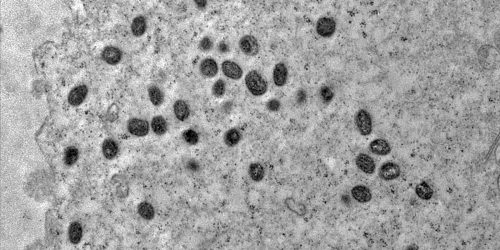 Mpox ainda é problema de saúde pública, dizem especialistas da Fiocruz Mpox ainda é problema de saúde pública, dizem especialistas da Fiocruz