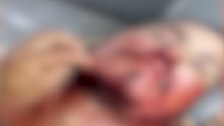CHACINA EM SINOP: vídeo mostra atirador morto logo após confronto