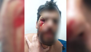 Homem é agredido durante abordagem da GM no Riviera