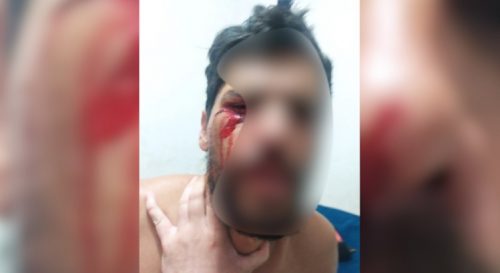 Imagem referente a Homem é agredido durante abordagem da GM no Riviera