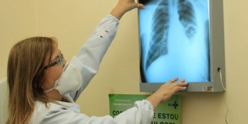 Imagem referente a Conselho aprova novas diretrizes para tratamento da tuberculose no SUS