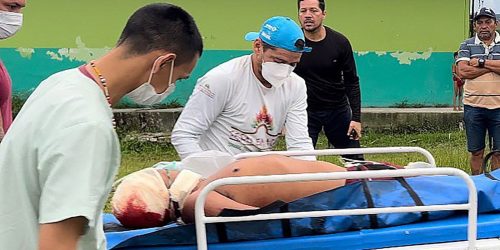 Imagem referente a Um indígena é morto e dois são feridos em ataque na Terra Yanomami