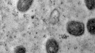 OMS declara fim da emergência em saúde por mpox