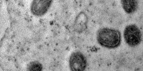 Imagem referente a OMS declara fim da emergência em saúde por mpox
