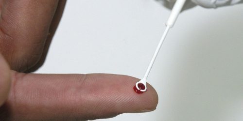 Imagem referente a Medicamento injetável é nova opção de prevenção contra HIV no Brasil