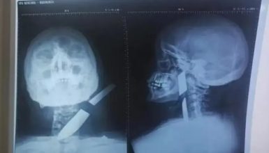 Imagem referente a Homem é preso após cravar faca no pescoço de ex-mulher e desferir machadada em adolescente