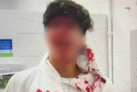 Imagem referente a Universidade suspende acadêmicos após briga “sangrenta” em pátio; veja vídeo!