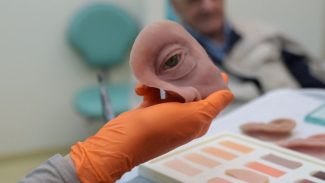 HR produz pelo SUS próteses faciais que recuperam autoestima dos pacientes