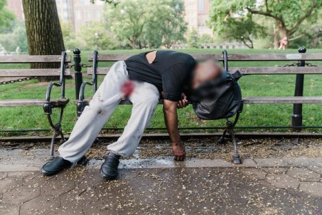 Imagem referente a Morador de rua tem parte do pênis decepado durante brincadeira com anel sexual