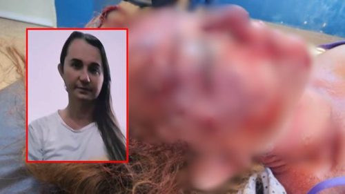 Imagem referente a Morre aos 37 anos detenta trans espancada brutalmente em penitenciária