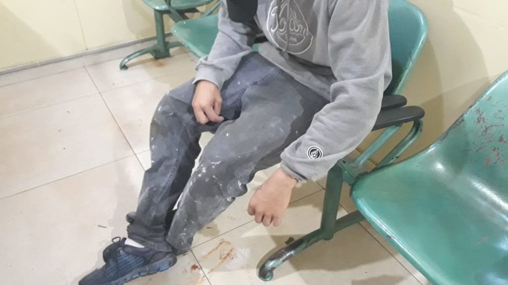 Jovem é preso com aparelho televisor furtado, no Bairro Cascavel Velho