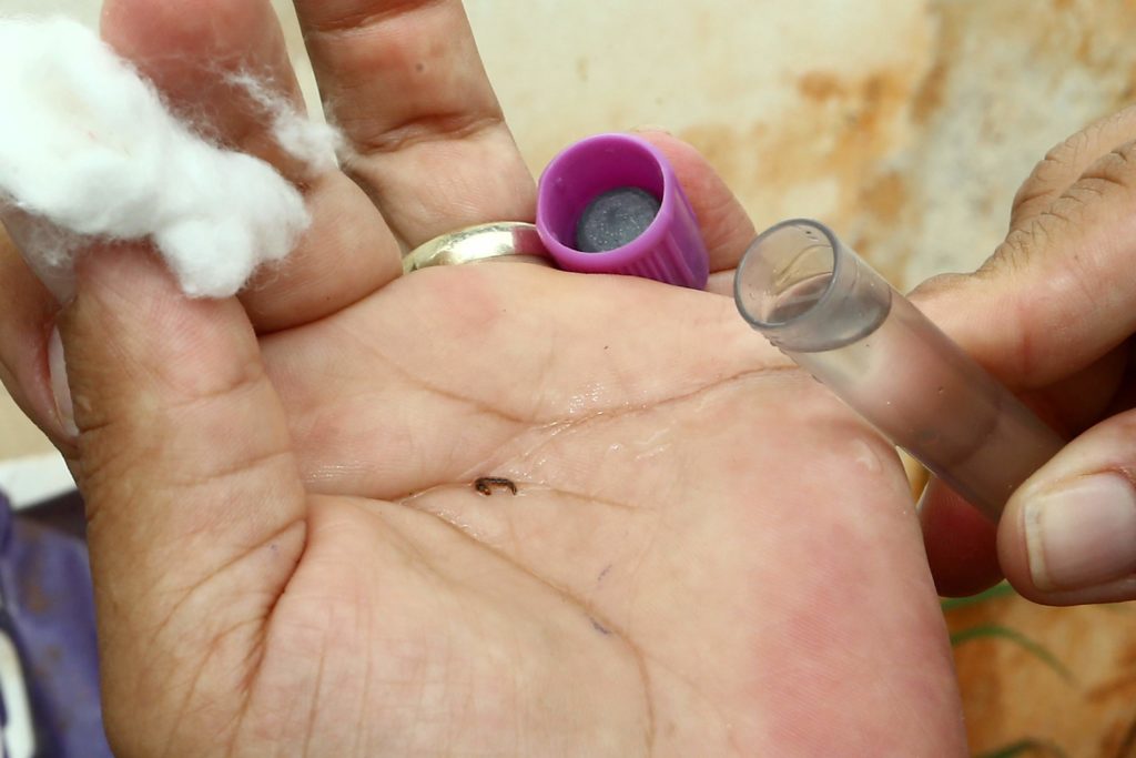 Guaíra registra primeira morte por Dengue hemorrágica