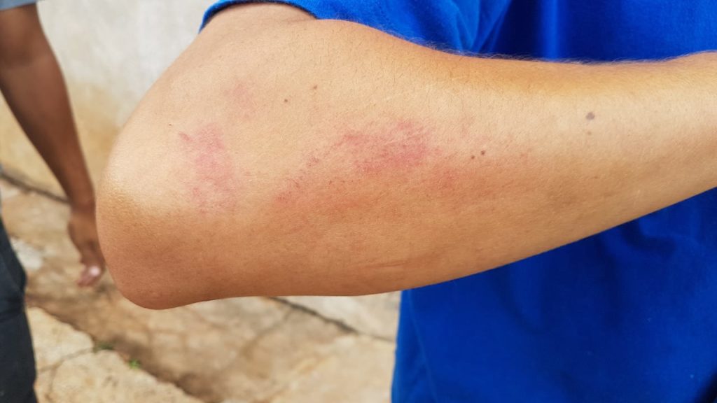 Jovens afirmam que foram agredidos em abordagem da Guarda Municipal