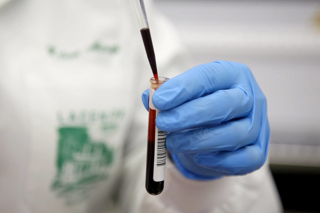 Lacen agiliza testes e ganha reforço no quadro de funcionários
