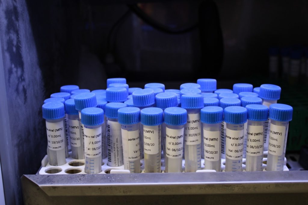 Cascavel testa mais pacientes suspeitos com sintomas da Covid-19