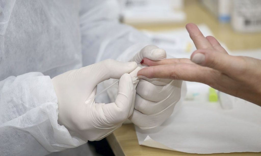 Sesa recebe testes rápidos de empresa em parceria com o Tecpar
