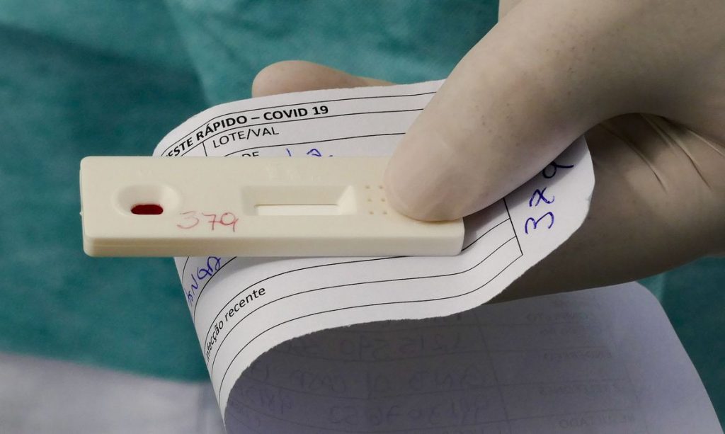 Paraná chega a 1 milhão de testes e amplia a capacidade