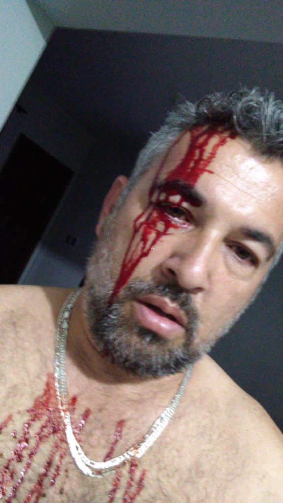 Vereador detido por violência doméstica se defende com foto ensanguentado