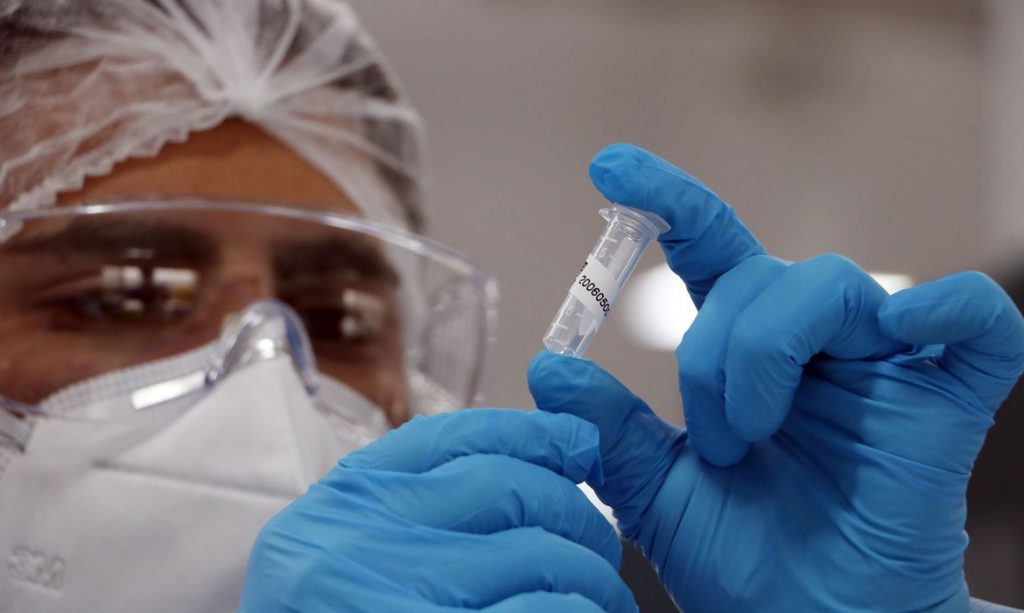 Disparada de casos de covid-19 leva IBMP a dobrar número de testes RT/PCR