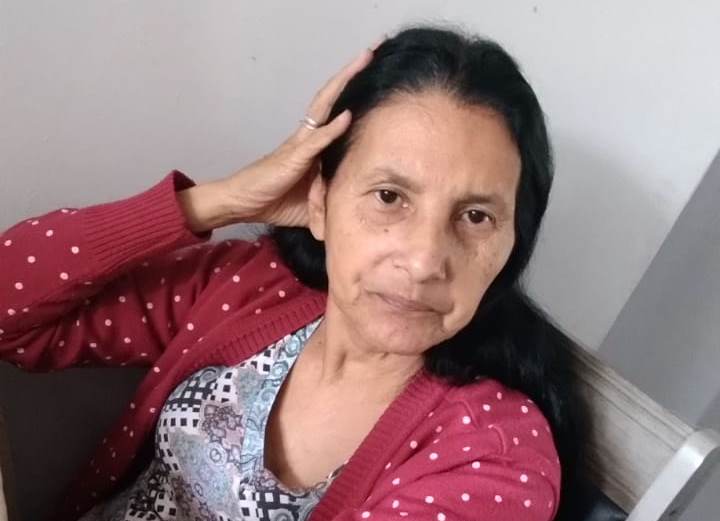 Mulher precisa de cirurgia na cabeça e família faz campanha Imagem referente a Mulher precisa de cirurgia na cabeça e família faz campanha