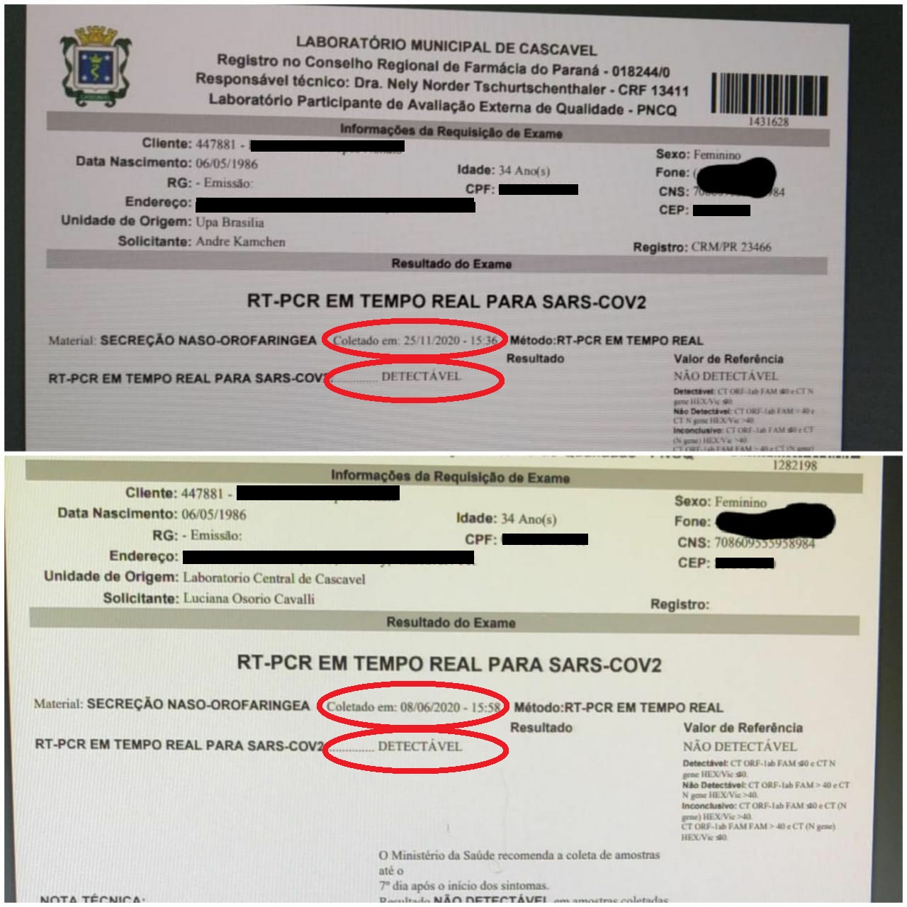 Servidora da saúde diagnosticada com Covid-19 pela 2ª vez faz alerta: é preciso manter cuidados Imagem referente a Servidora da saúde diagnosticada com Covid-19 pela 2ª vez faz alerta: é preciso manter cuidados