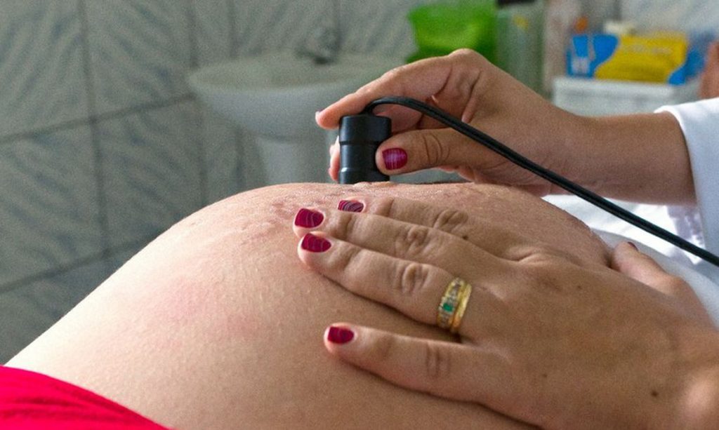Secretaria de Saúde deve informar sobre medidas tomadas para vacinação de gestantes no Paraná