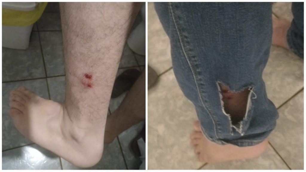 Trabalhador de serviço de entregas relata ataque de cães no Conjunto Riviera