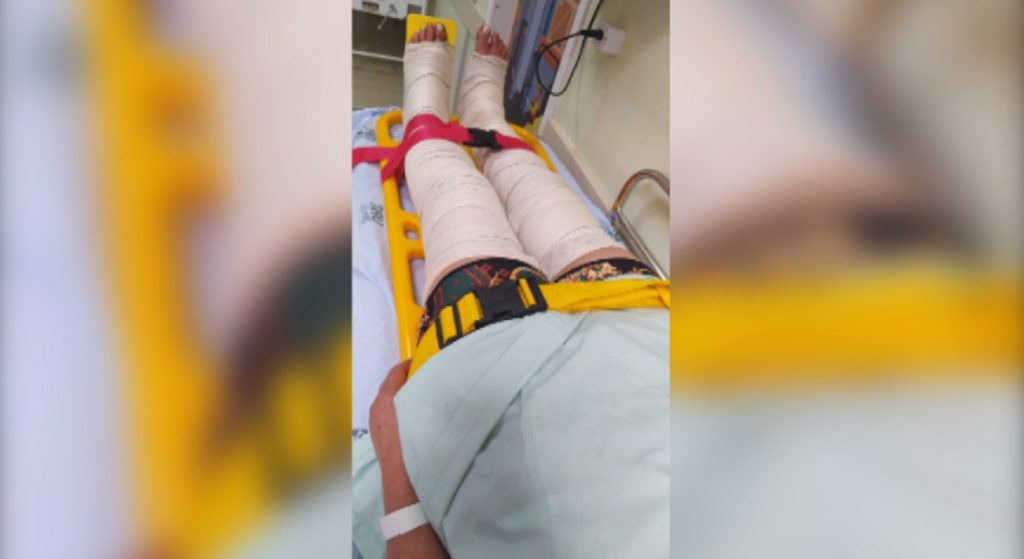 Mulher que está cuidando da mãe internada no Hospital Universitário precisa de doações