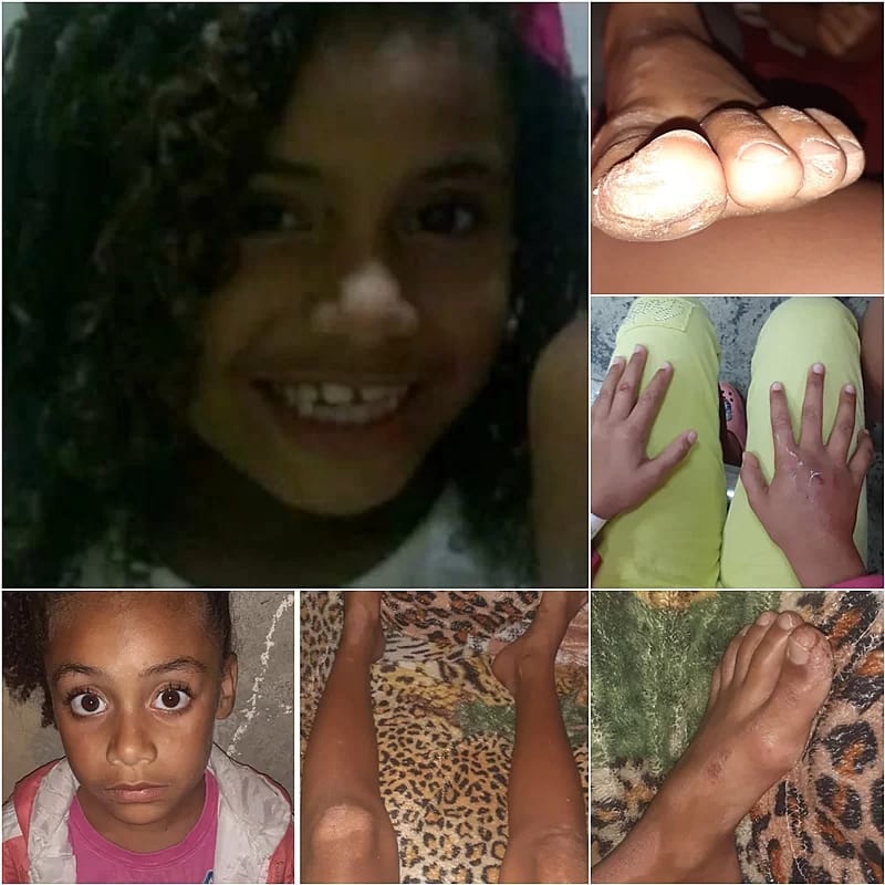 Vakinha: Ajude com o tratamento da pequena Thalia Mirella