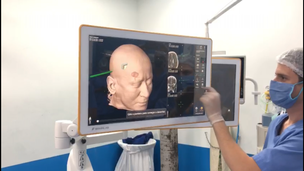 Sesa adquire equipamento de ponta para neurocirurugias guiadas; primeira cirurgia foi realizada hoje