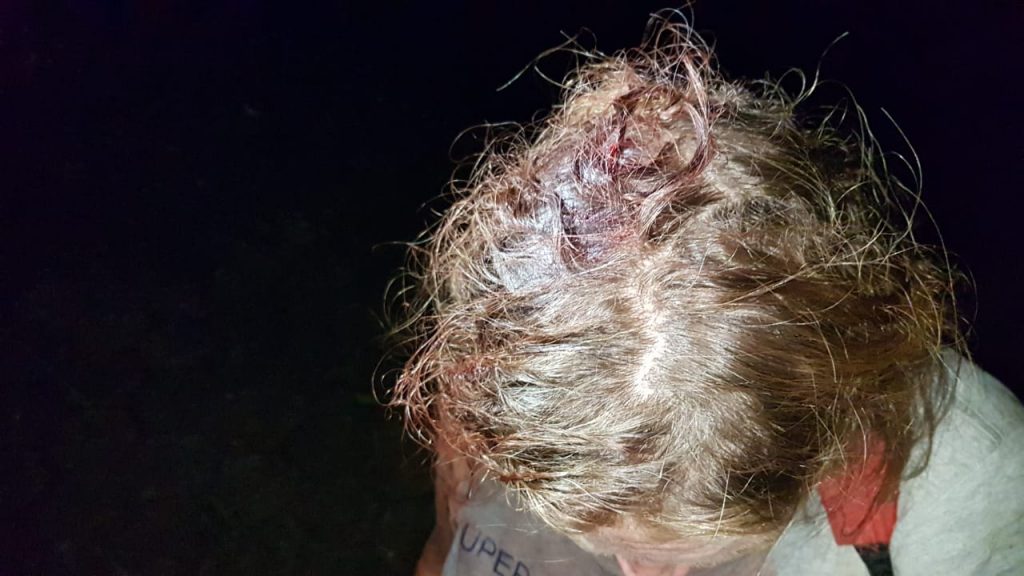 ‘Não quis ir ao hospital por medo de pegar Covid’, diz mulher com corte na cabeça após ser agredida; Siate prestou atendimento