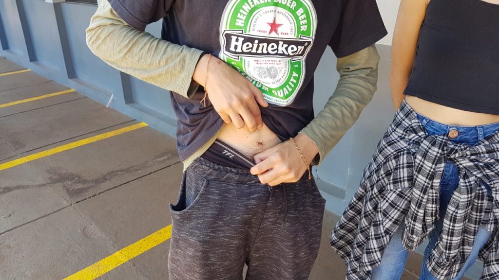 Jovem esfaqueado pelo ex da namorada relata como ocorreu a confusão