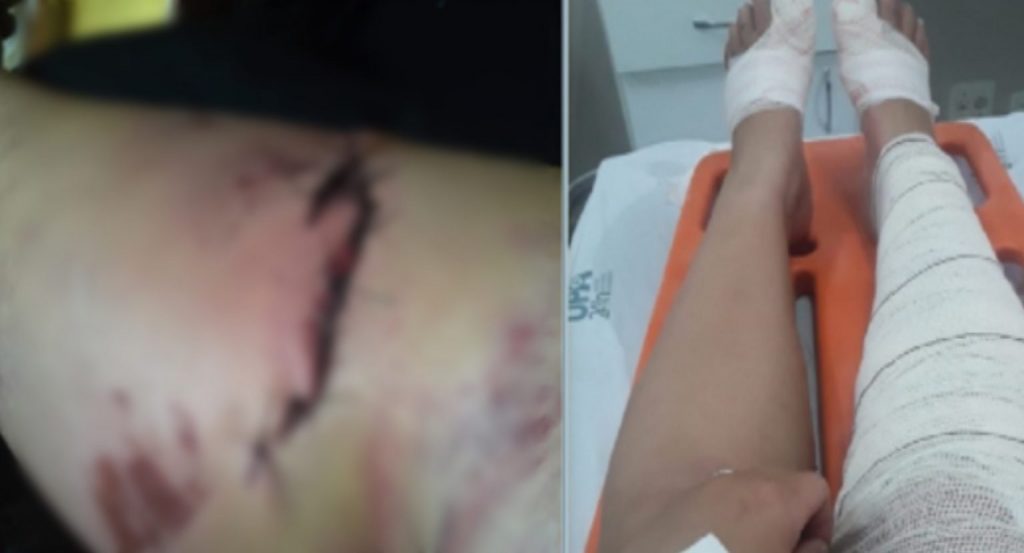 Com ajuda ‘do bem’, casal que se envolveu em forte colisão no São Cristóvão já conseguiu quitar cinco das oito contas