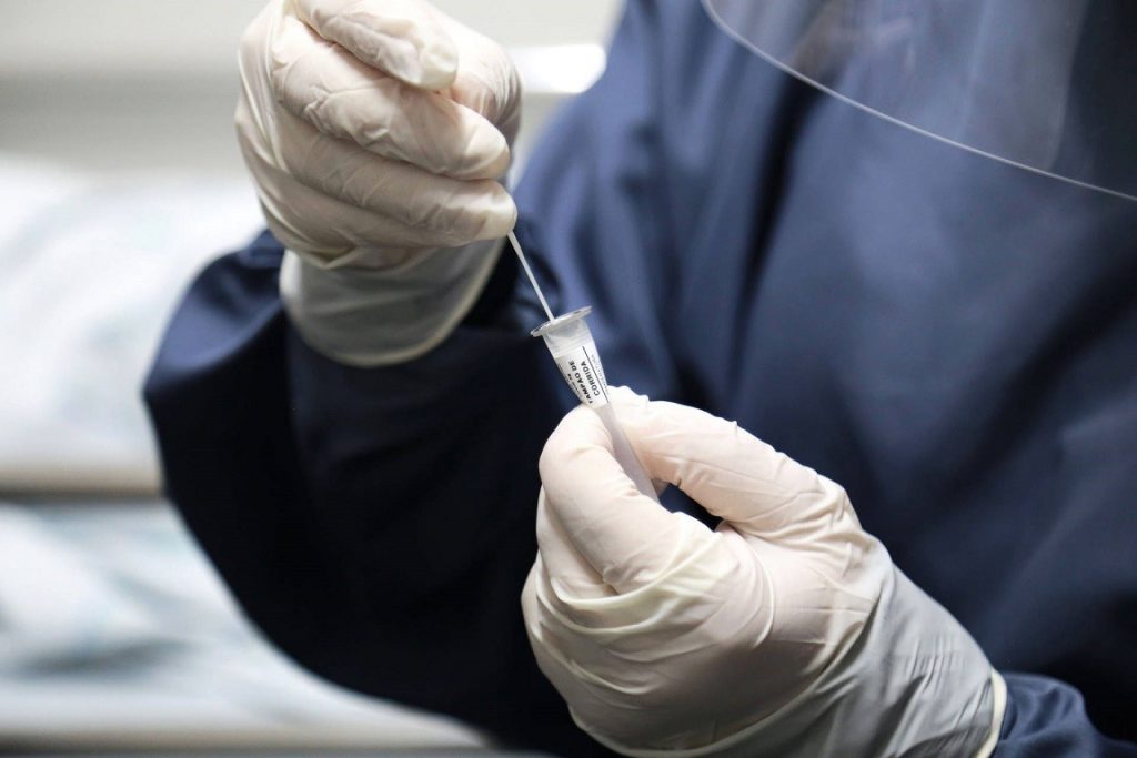 Estado distribui testes rápidos e oxímetros para municípios das 22 Regionais de Saúde