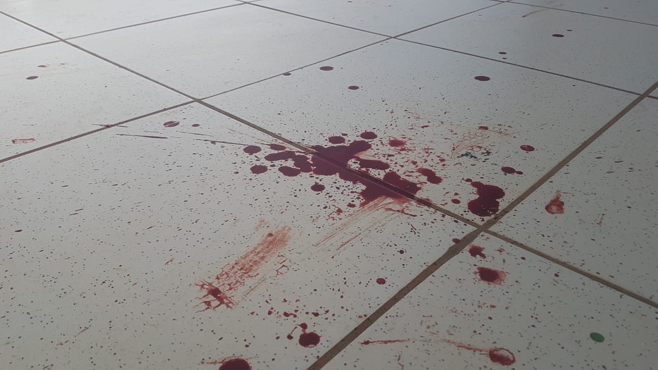 Esfaqueados no Ciro Nardi: Terceiro jovem relata que já foi vítima de assalto por agressor; Veja o relato