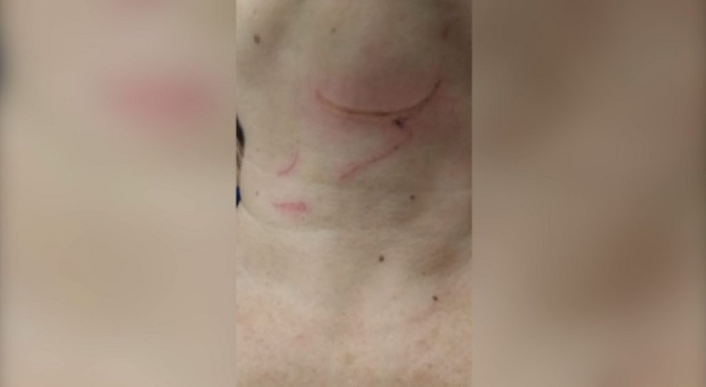 Mulher tem o pescoço atingido por linha de pipa no Loteamento Florais do Paraná; Moradores fazem alerta Mulher tem o pescoço atingido por linha de pipa no Loteamento Florais do Paraná; Moradores fazem alerta