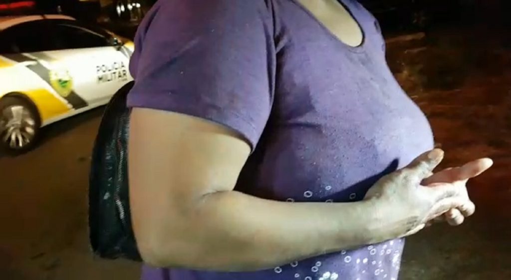 “Quando você descobre mensagem da pessoa com outra mulher, dói”, diz vítima de agressão no Parque São Paulo