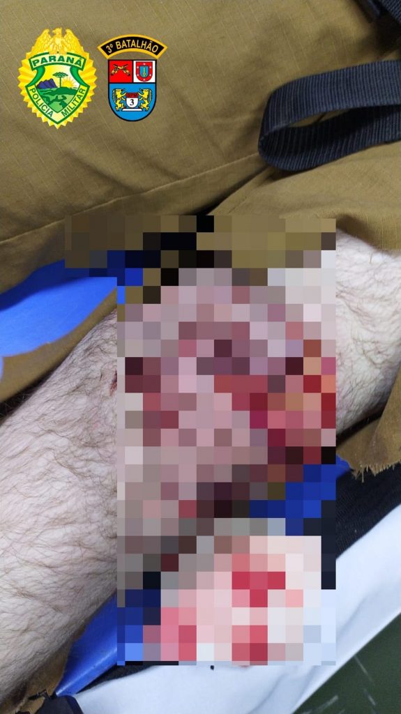 Motorista embriagado é detido após atropelar policial militar em Clevelândia