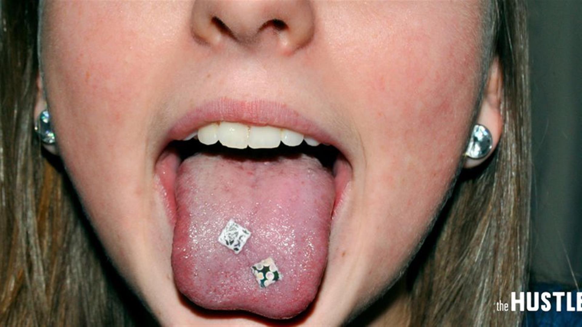 Piercing Oral na Adolescência